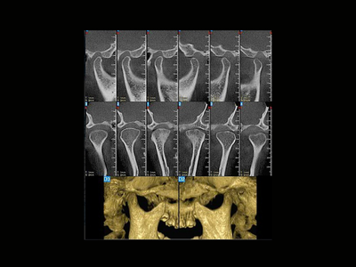 radiogyn-radiologia-tomografia-atm